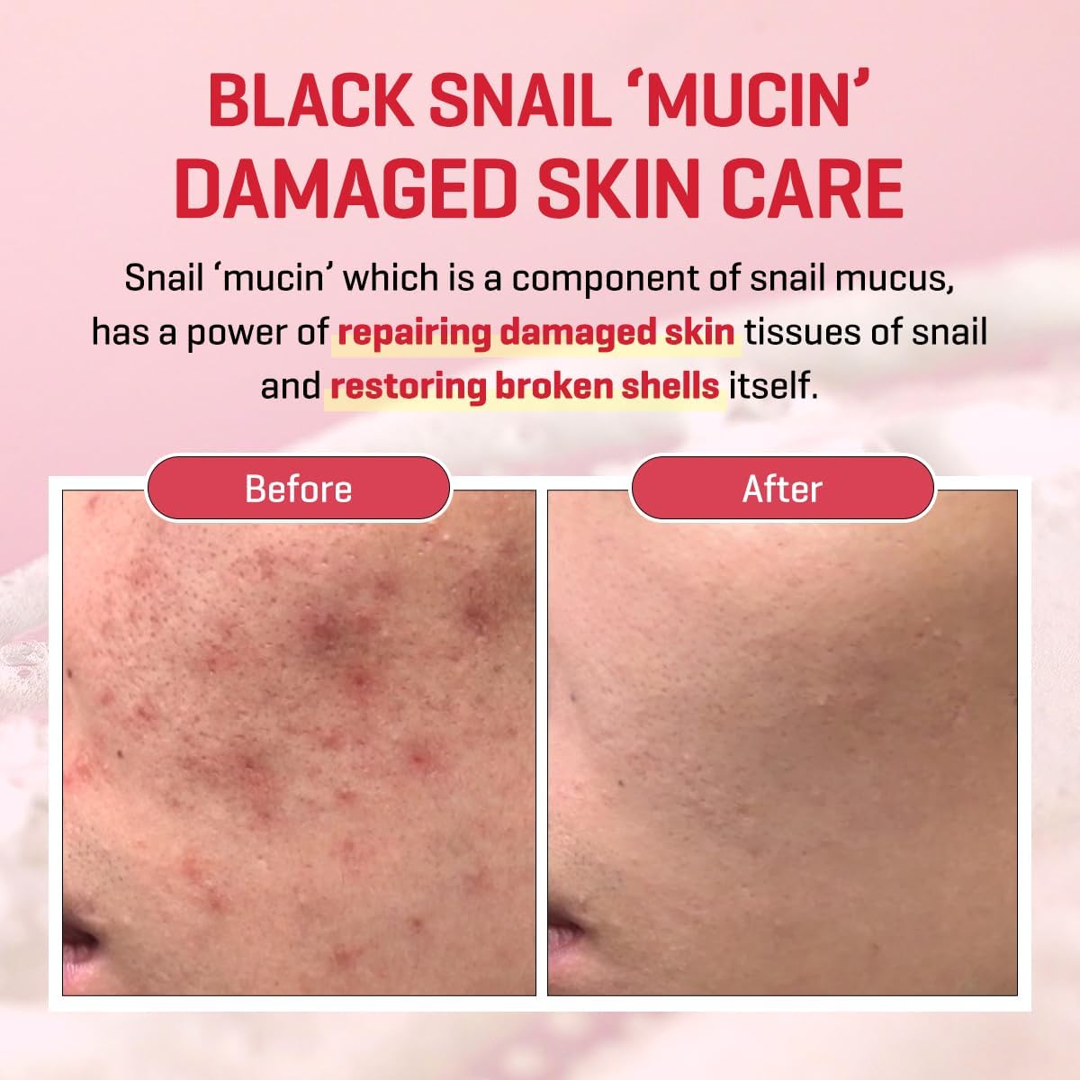 Snail Truecica Miracle Repair Serum